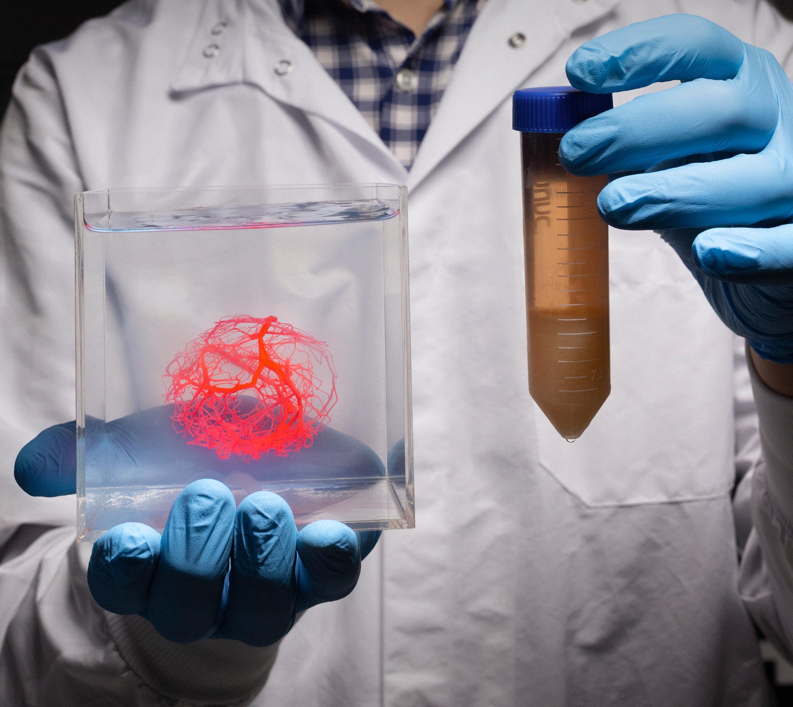 Estudio del ictus con impresión 3D Estudio del ictus con impresión 3D