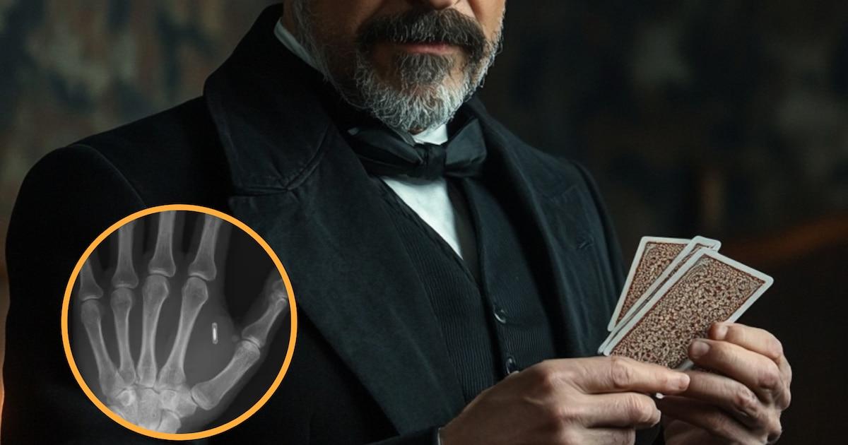 Implante de chip RFID para trucos de magia Implante de chip RFID para trucos de magia